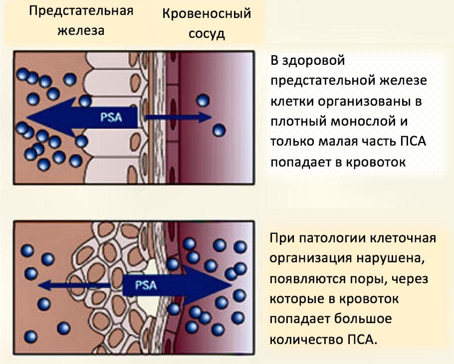 ПСА – протеин, который продуцируется у мужчин